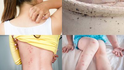 Signs And Symptoms Of Bed Bugs